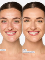 shape tape™ creamy concealer